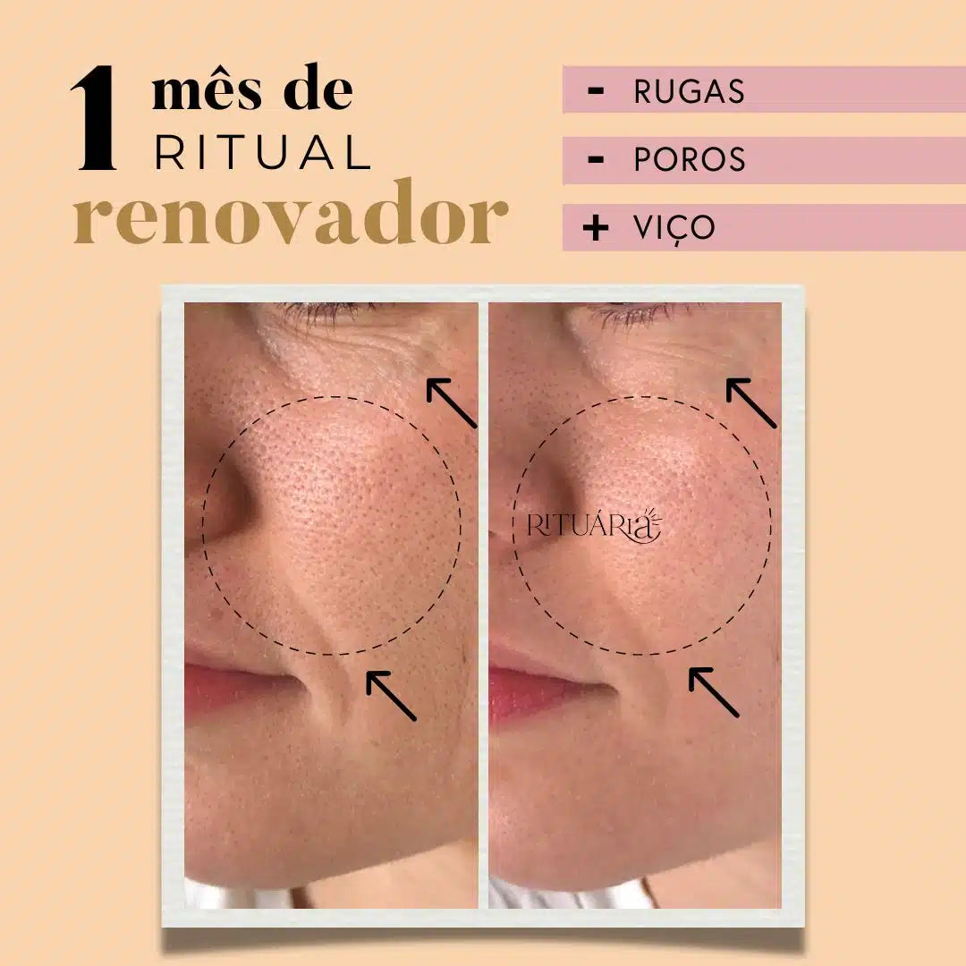 Fórmula Renovadora