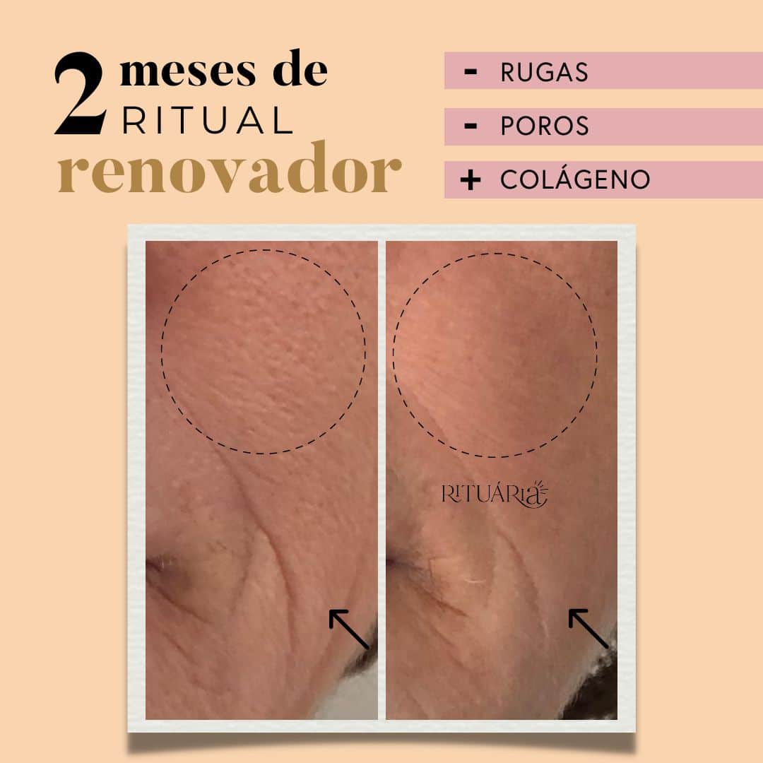 Fórmula Renovadora