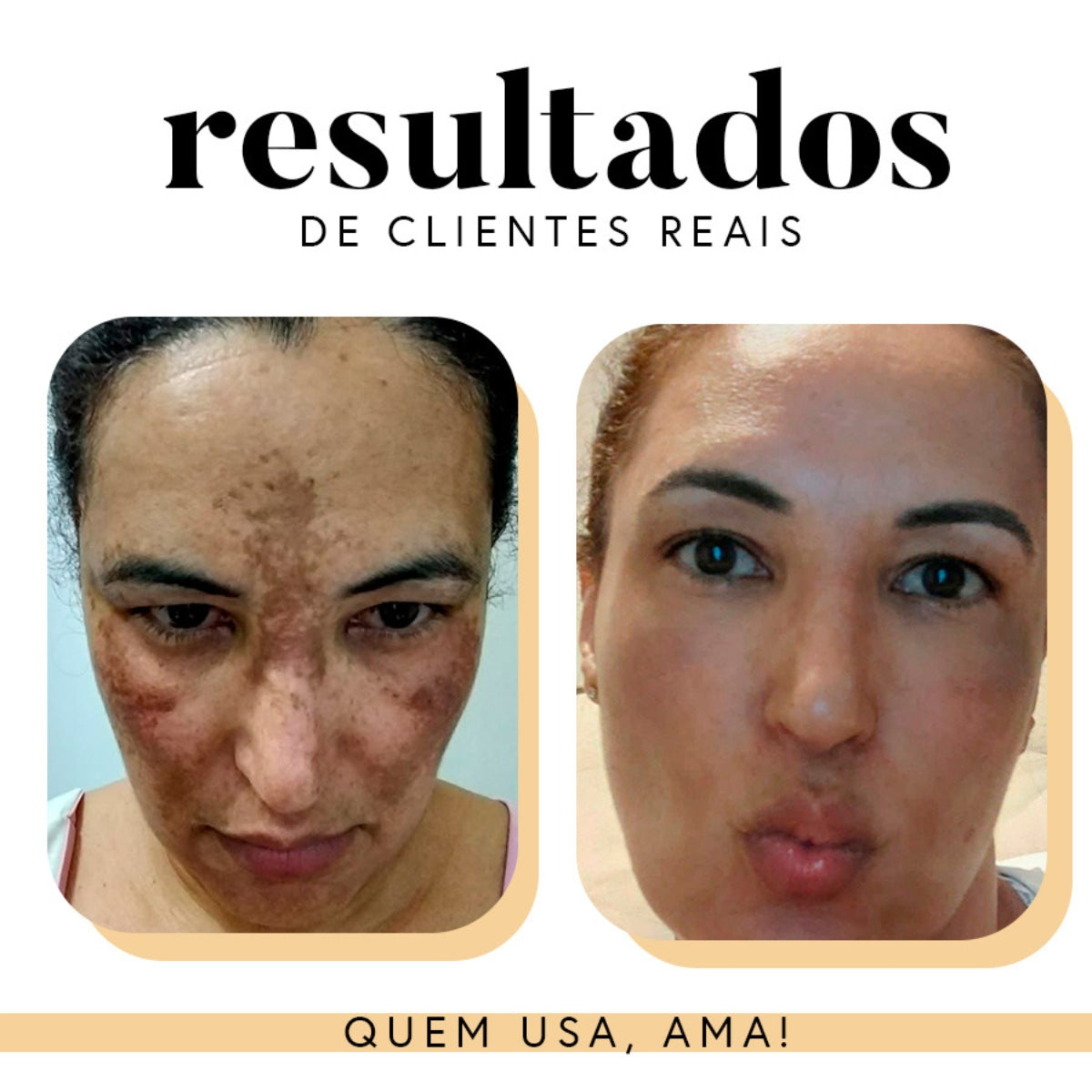 Fórmula Antioxi Nutri - 90 cápsulas