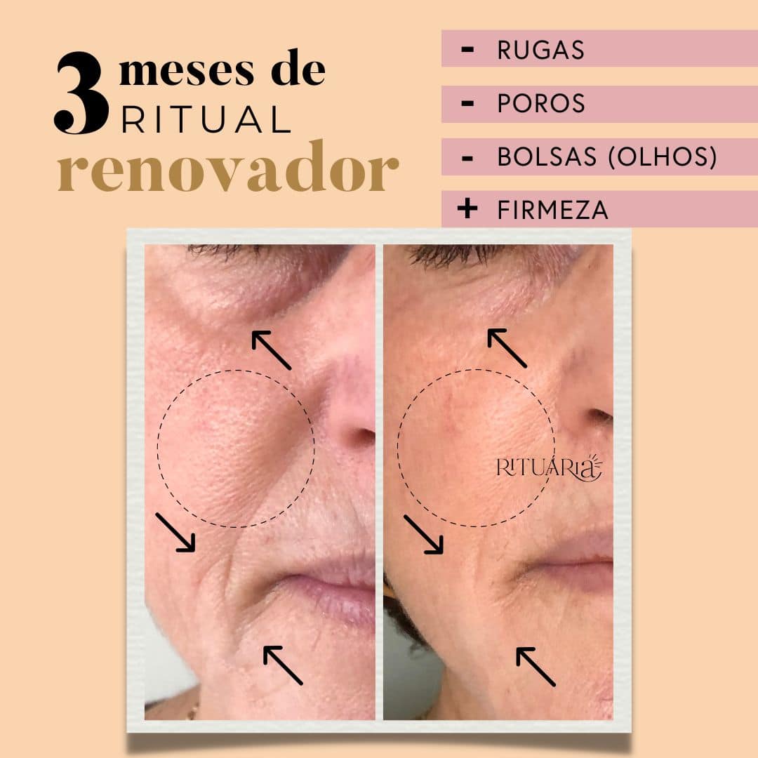 Fórmula Renovadora
