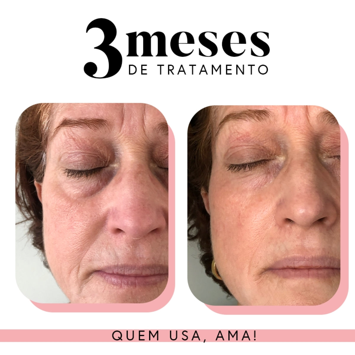 Fórmula Renovadora